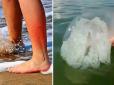 Величезні жалючі медузи атакували узбережжя Азову (відео)
