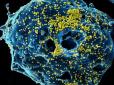 Потенційно хворого на коронавірус виявили в Житомирі