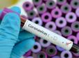 У ще одній області України виявили серйозну підозру на коронавірус