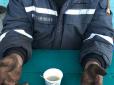 Чорні руки і обпечені до дірок ноги: Рятувальник з Чорнобиля показав моторошні наслідки роботи (фото)