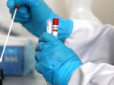 Світ знову не може спати спокійно: Новий штам коронавірусу виявлено на півдні Франці