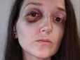 Виявилися студентами місцевих коледжів: У Львові поліція встановила особи підлітків, які побили жінку в трамваї